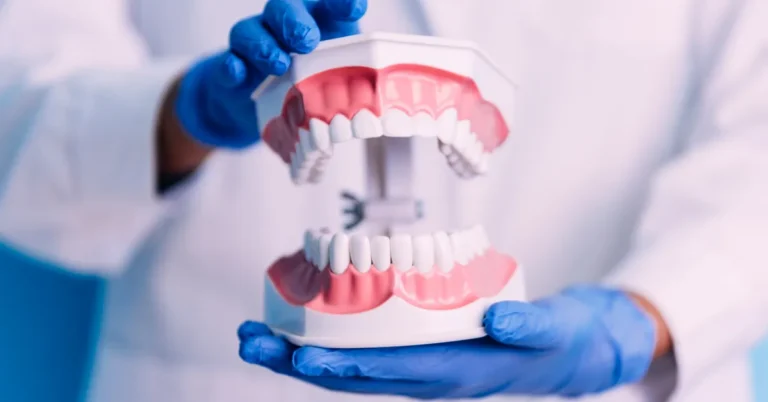 Dentist wearing blue gloves holding a full-mouth dental model used to explain pre-prosthetic surgery or denture preparation.