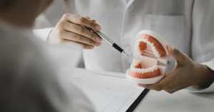 Oral surgeon at Arizona Center for Oral Surgery in Glendale, Arizona, explaining treatment options using a dental model for implants and All-on-4 procedures.
